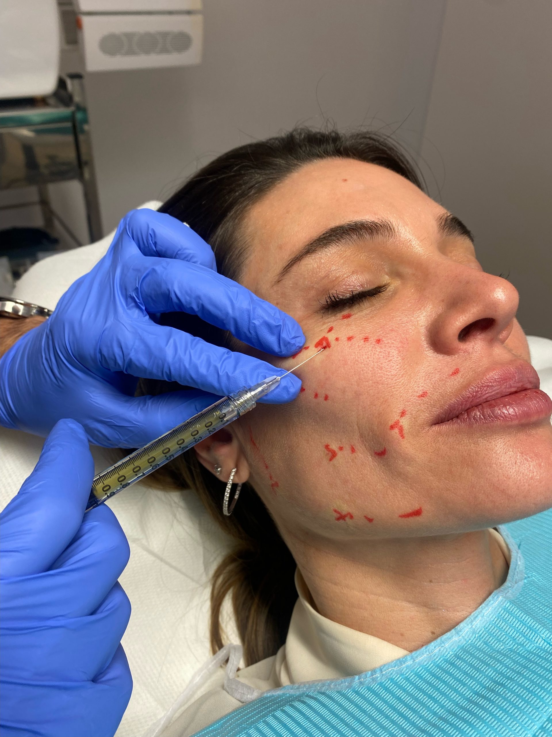 Hablamos con María Cudeiro sobre belleza, medicina estética y sobre el Plasma Rico en Plaquetas