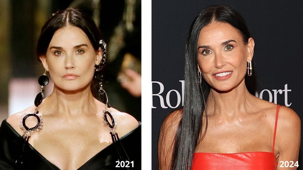 Demi Moore, Brad Piit, tratamientos faciales