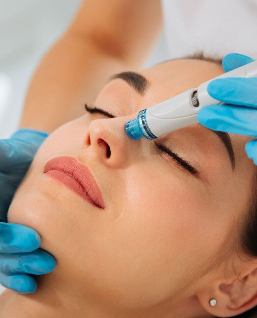 tratamiento Aquapure limpieza facial