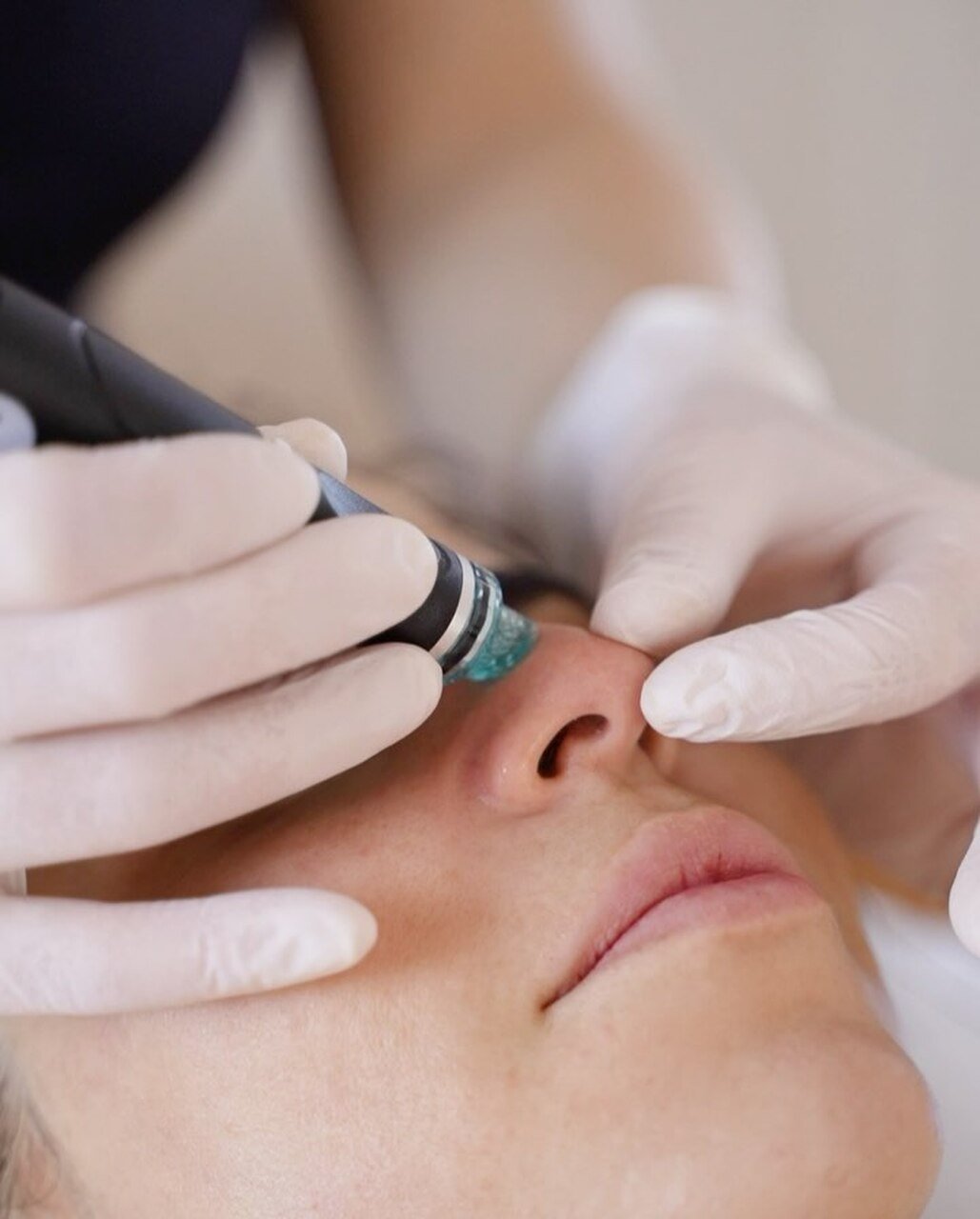 entrevista medicina estetica