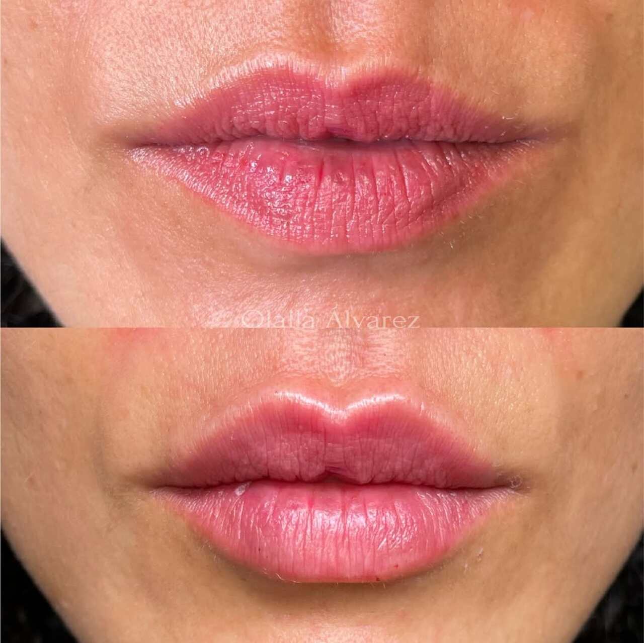 retoque de labios