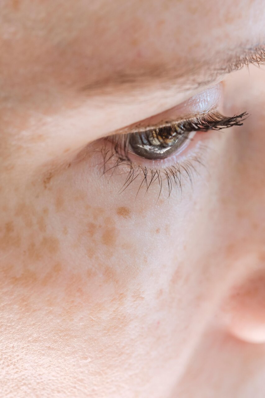 piel pecas