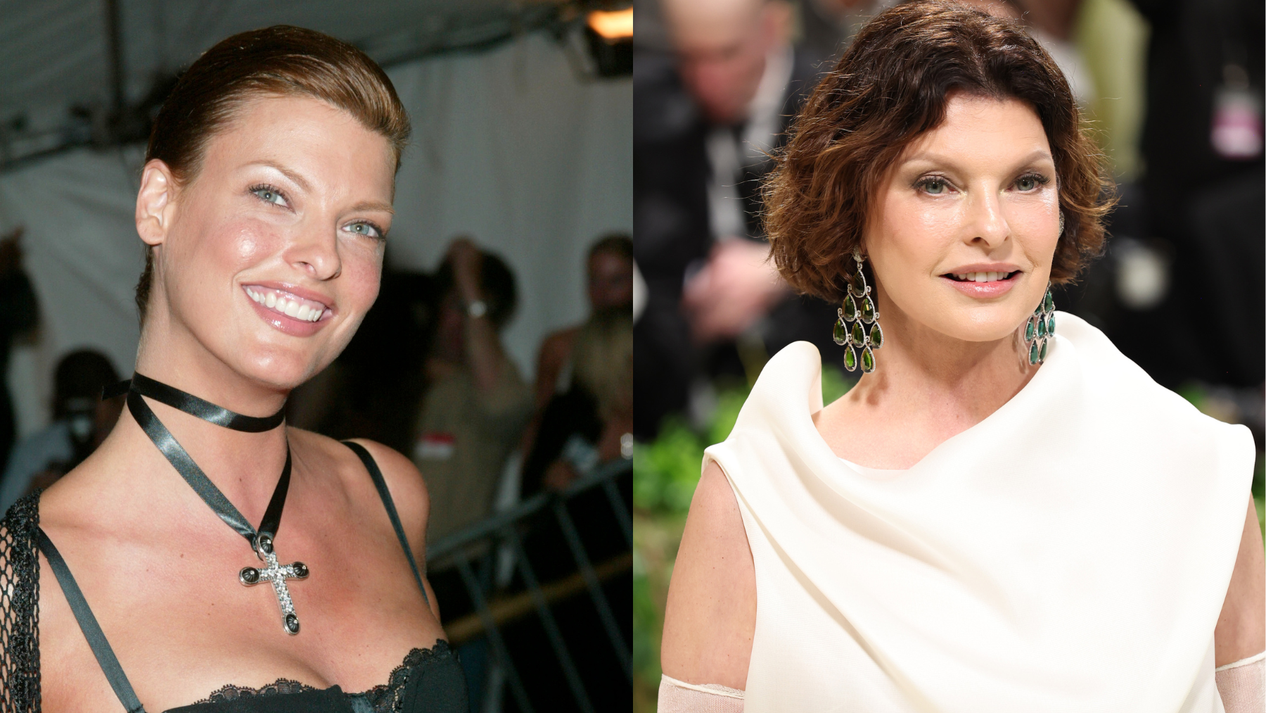 peores operaciones esteticas celebrities