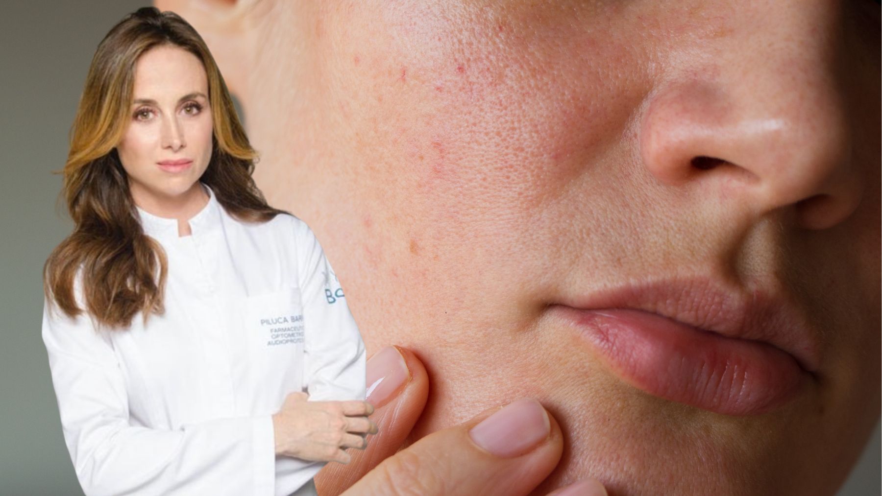 Pilar Barrau sobre piel atópica: El estrés eleva la hormona que debilita la barrera cutánea y se agrava