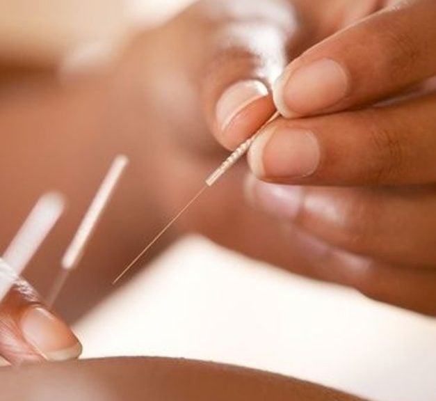 Apucuntura, estrés