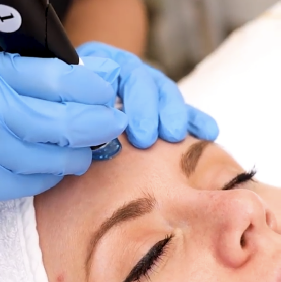 Maribel Yébenes, Hydrafacial