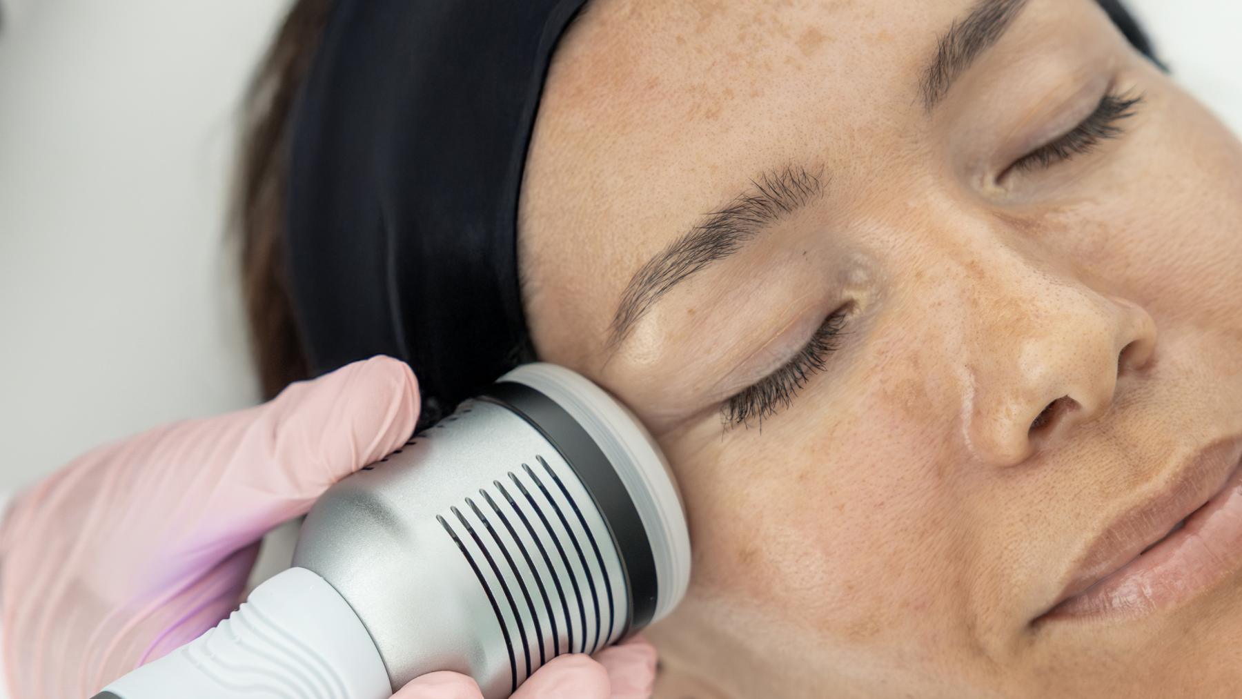 ZEM Wellness Clinic Altea nos propone cuidar la piel con intervenciones clínicas no invasivas orientadas a la biología cutánea
