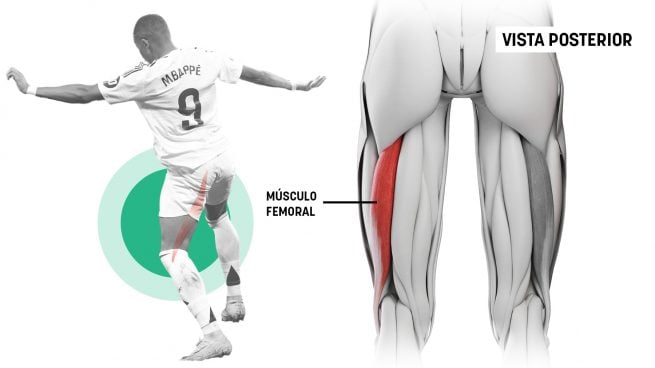 Mbappé lesión