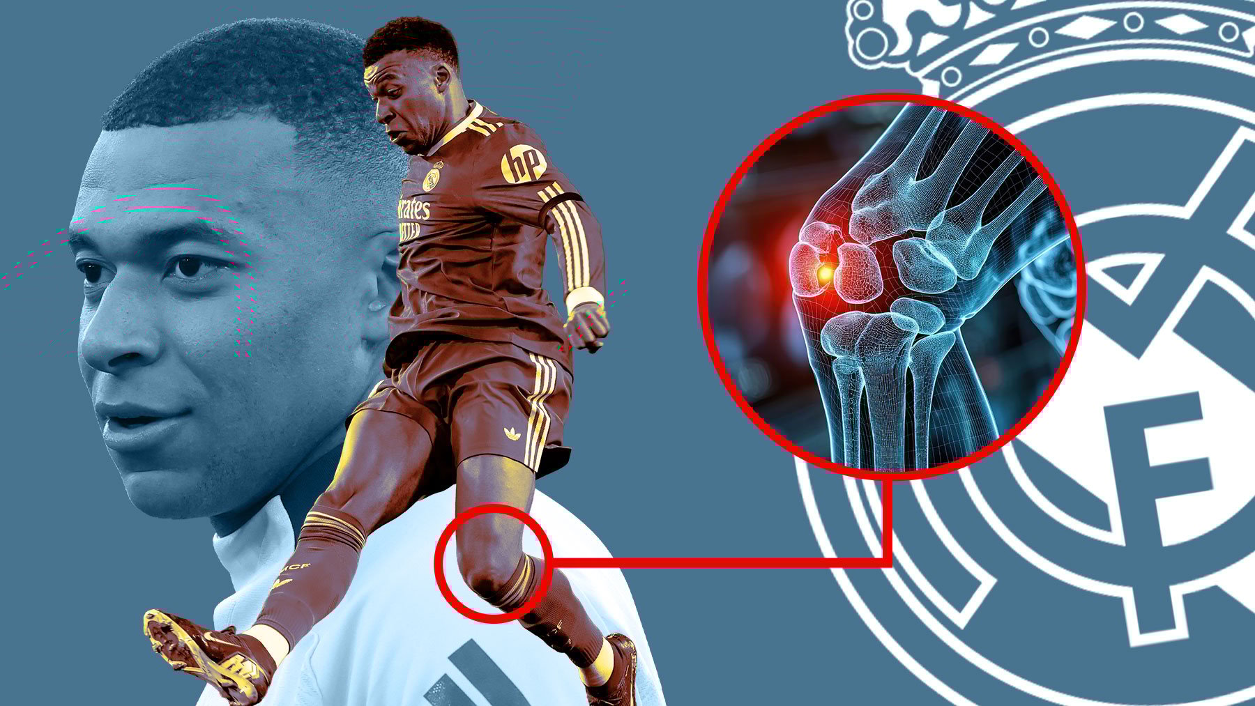 Alerta Mbappé: acortar plazos es peligroso y el riesgo de lesión aumenta