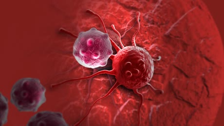 El c&aacute;ncer colorrectal ser&aacute; el tumor m&aacute;s diagnosticado en Espa&ntilde;a en 2026: as&iacute; puedes detectarlo de forma precoz