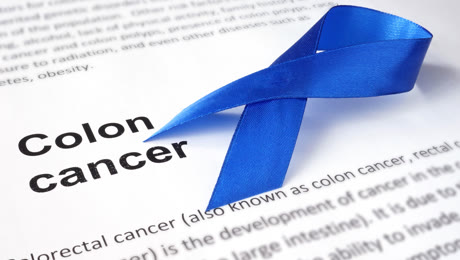 Resuelto el misterio de la bacteria que causa cáncer de colon