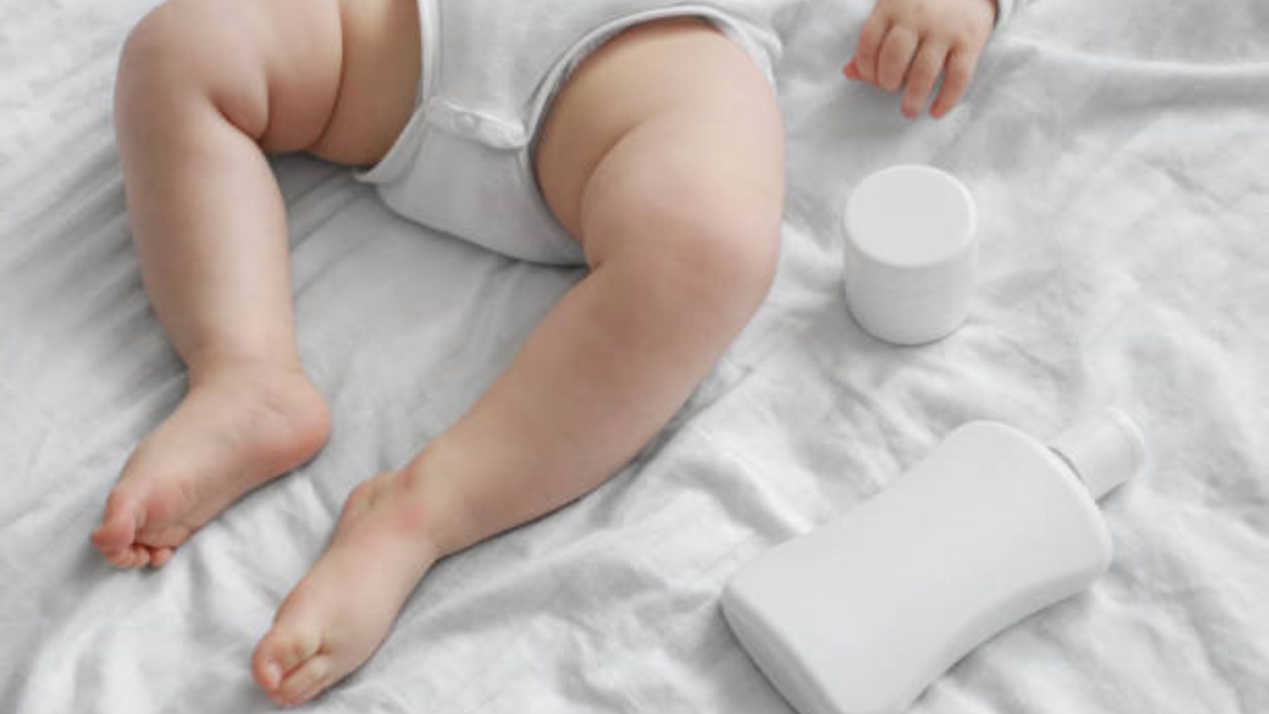 Dermatitis atópica de los bebés y cómo tratar