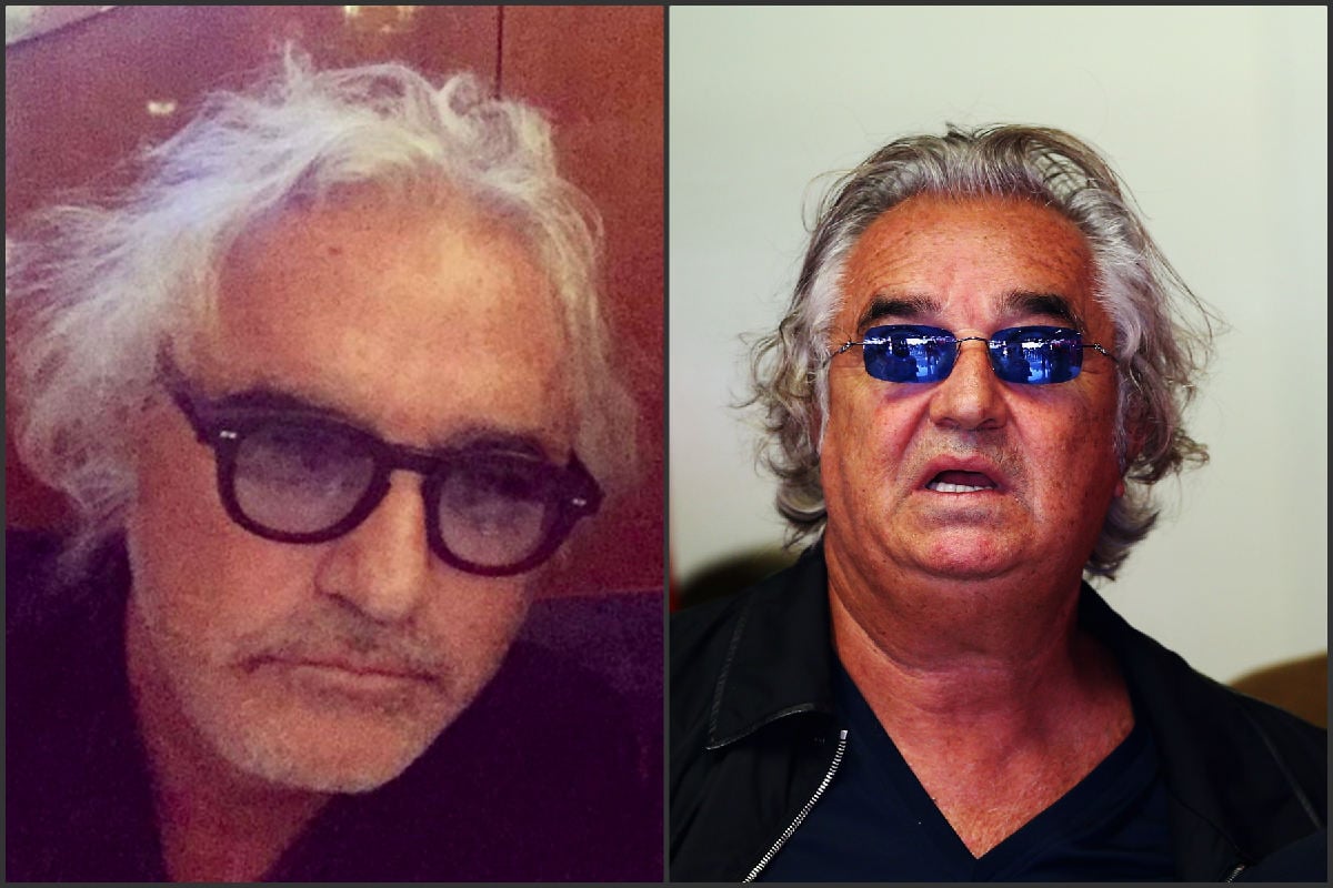 Flavio Briatore, antes y después de la operación.