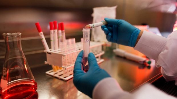 Equipo de investigación de la Universidad Complutense de Madrid logra un gran avance en el diágnostico de tumores cancerígenos en la boca. (Foto: Getty)