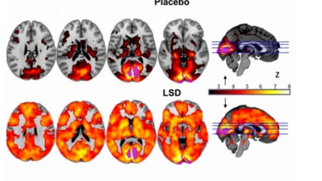 Un estudio científico revela por primera vez los efectos del LSD en el cerebro humano