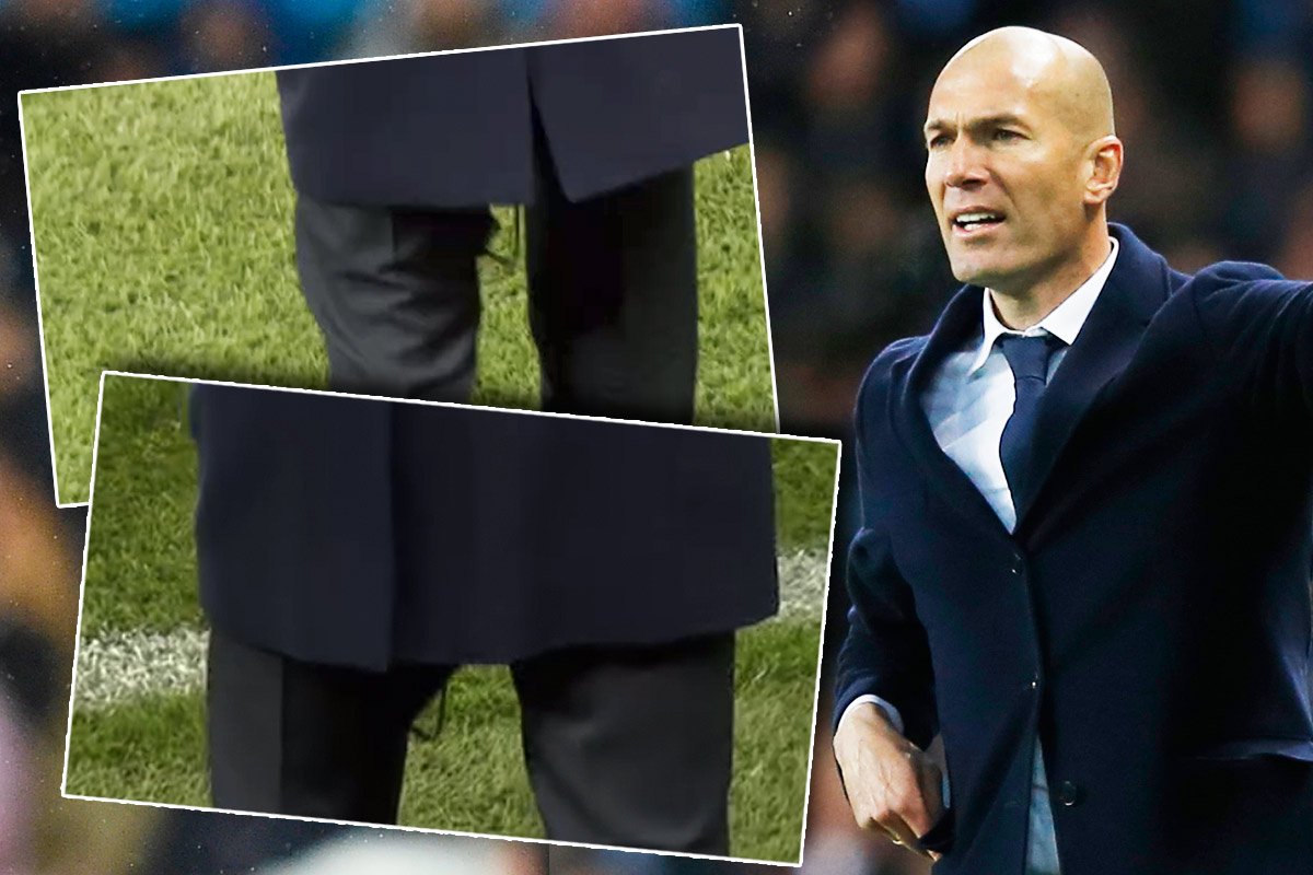 A Zidane se le volvió a romper el pantalón.