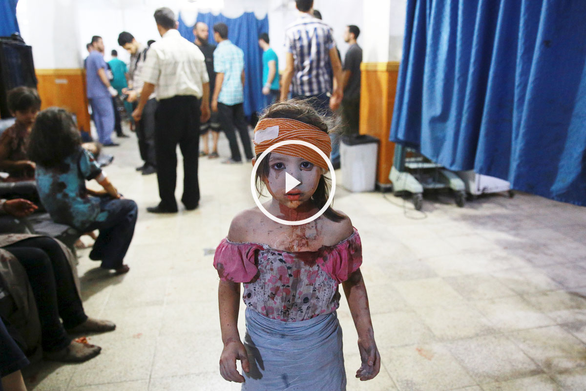 Una niña siria resulta herida en uno de tantos enfrentamientos en el país. (Foto: Abd Doumany/AFP)