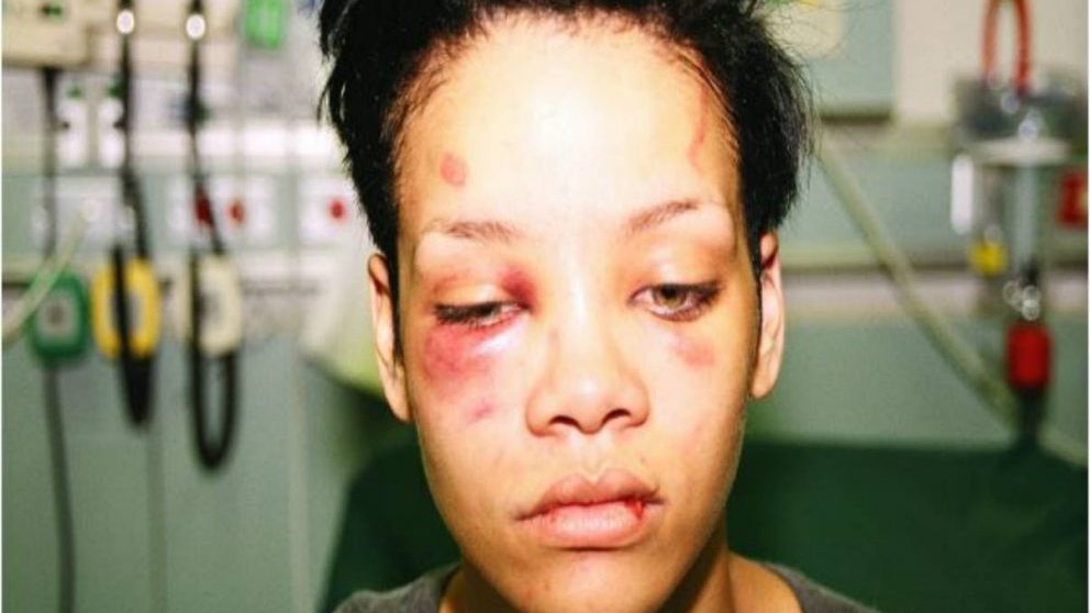 Rihanna golpeada por Chris Brown