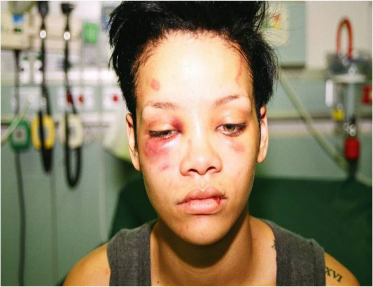 Rihanna golpeada por Chris Brown - 2009