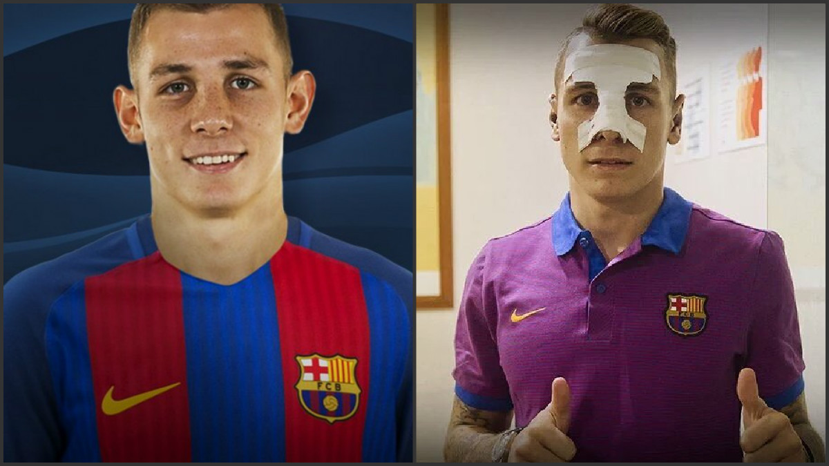 El antes y el después de Digne.
