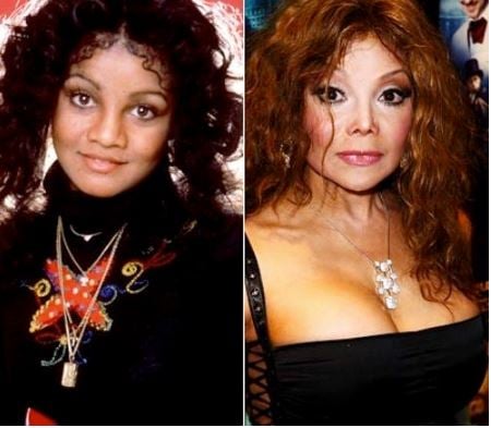 La Toya Jackson famosas cirugía