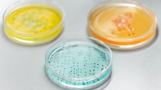 bacterias-virus