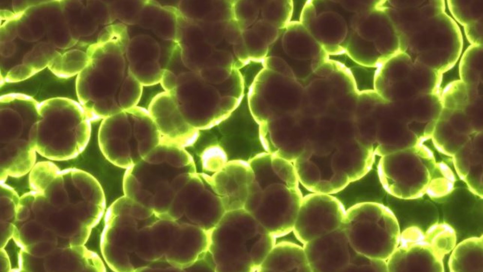 Microbios: Â¿Por quÃ© son importantes?