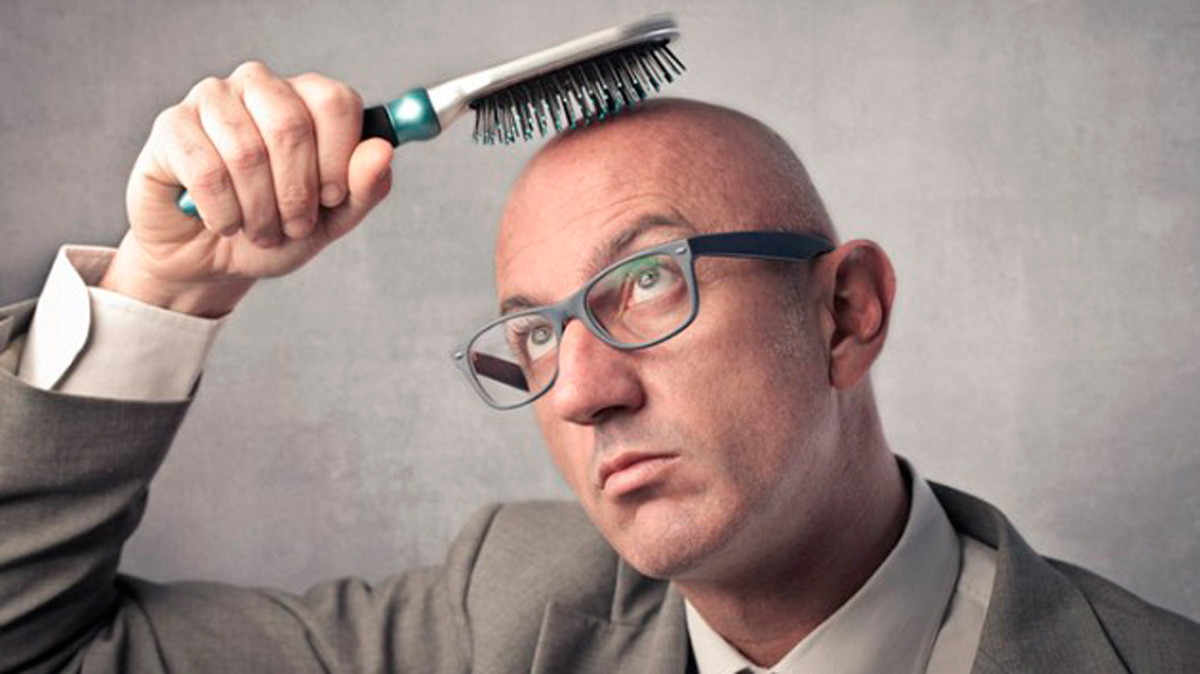 Te mostramos las causas, los tipos y la prevención de la calvicie