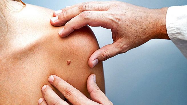erupciones cutáneas relacionadas con la diabetes erupciones cutáneas relacionadas con la diabetes