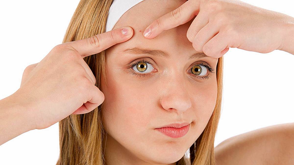 acne granos mitos frecuentes