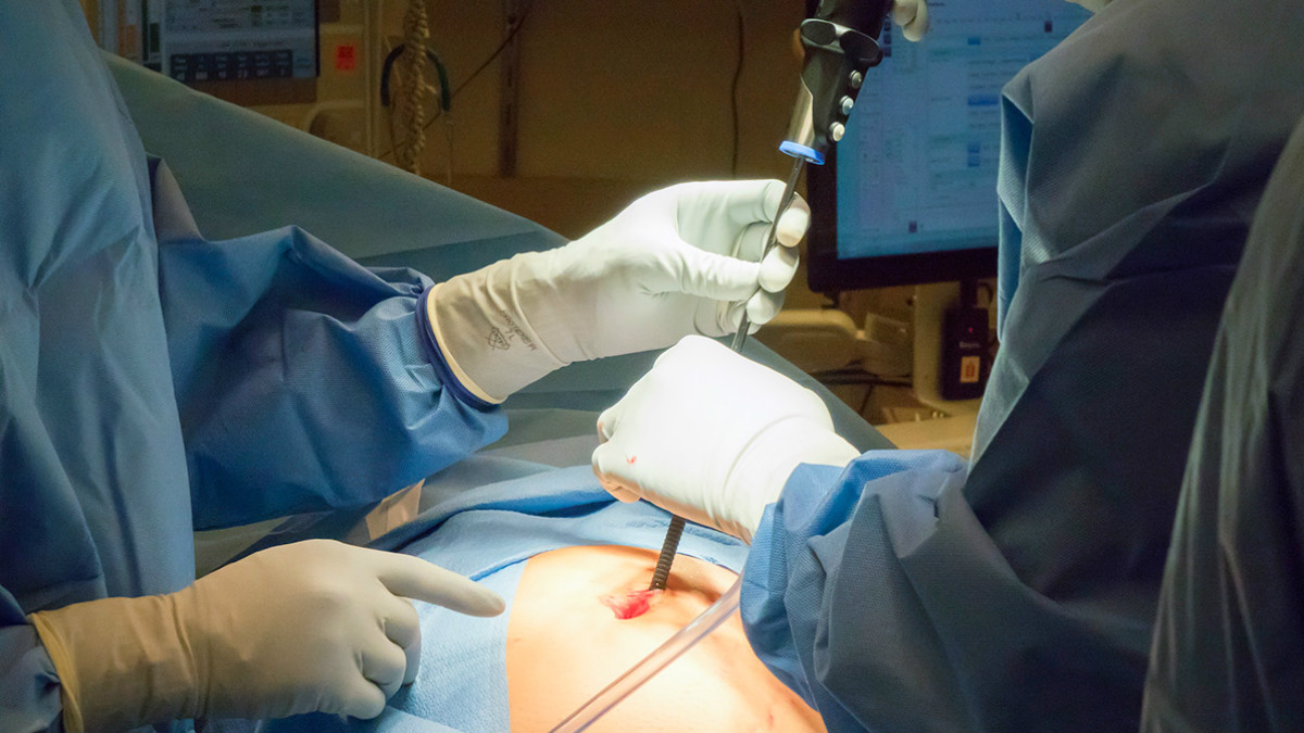 Médicos japoneses hallan tejido cerebral, craneal y pelos en un tumor ovárico de una niña de 16 años. (New Scientist)