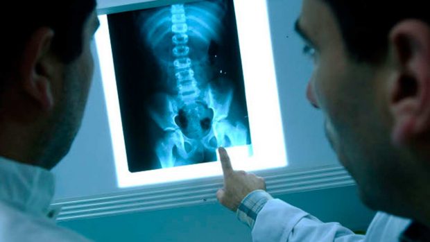 Los datos y usos más curiosos sobre los rayos X