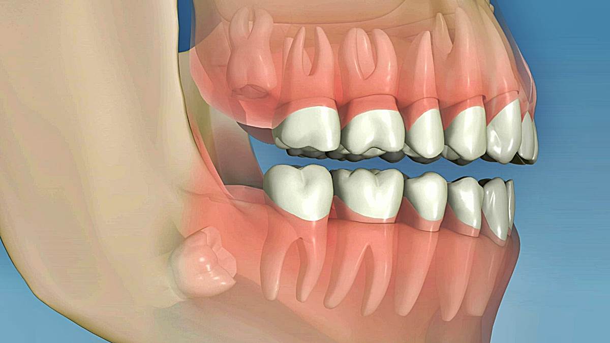 5 Partes Del Cuerpo Humano Que No Sirven Para Nada La Neta Neta