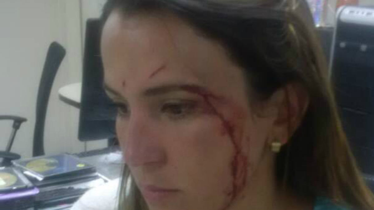 Periodista herida por las fuerzas de Maduro