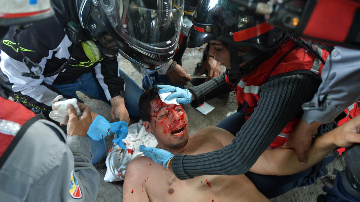 Un manifestante herido por la violencia de la represión de Maduro es atendido en Caracas. (AFP)