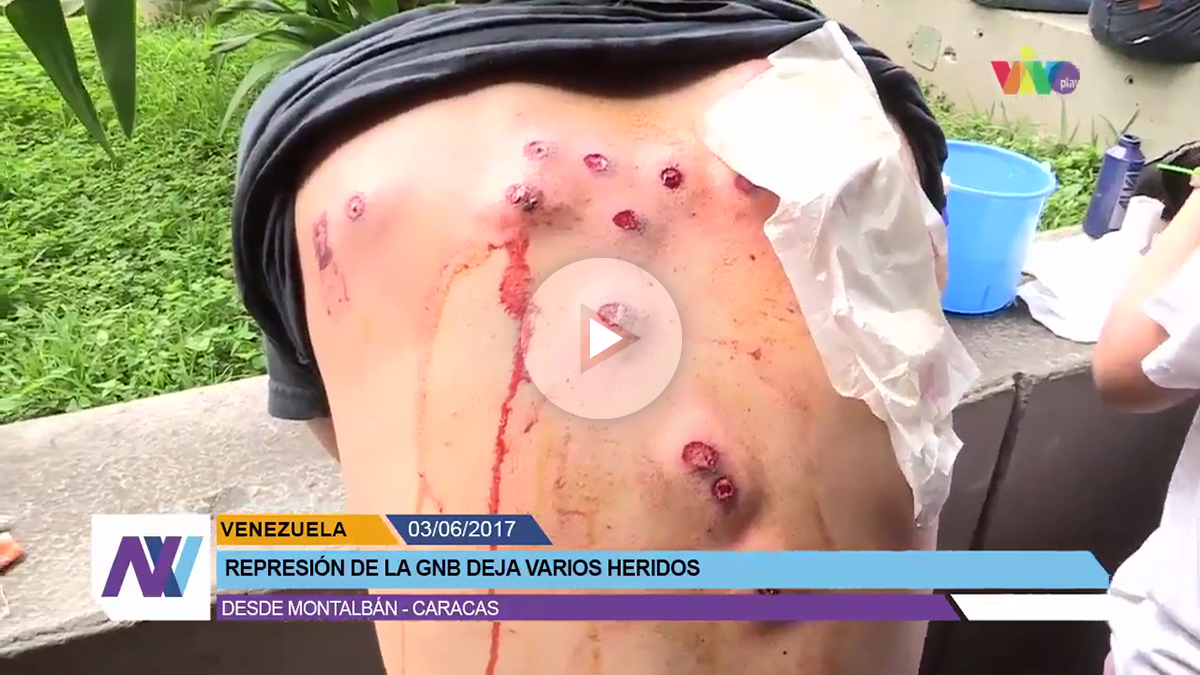 Un opositor muestra las heridas causadas por los cartuchos de balines disparados por la GNB en Caracas.