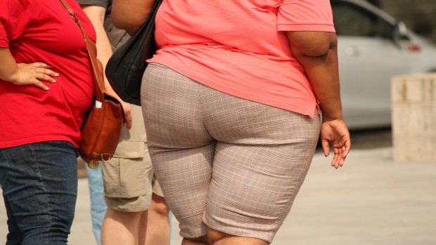 Obesidad mórbida: qué es y cuáles son sus causas