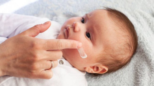 Eczema en bebé