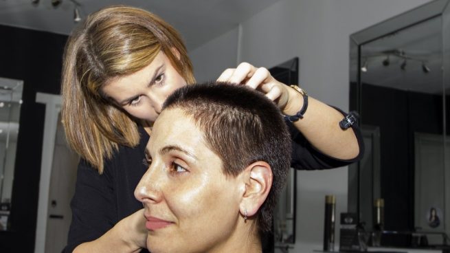 Qué es y cuáles son las causas de la alopecia femenina