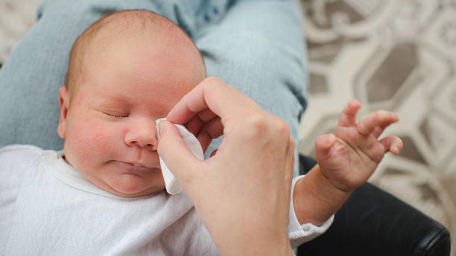 Causas y cómo tratar la conjuntivitis en los bebes