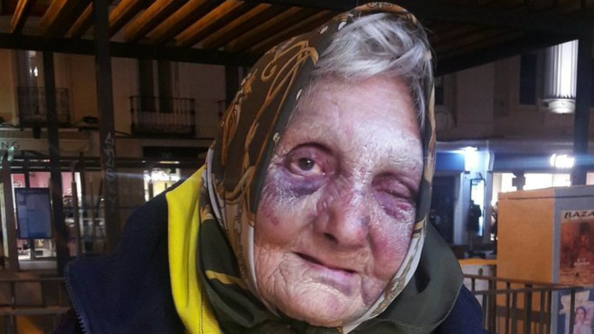 La mujer de 84 años sin hogar agredida en Madrid.