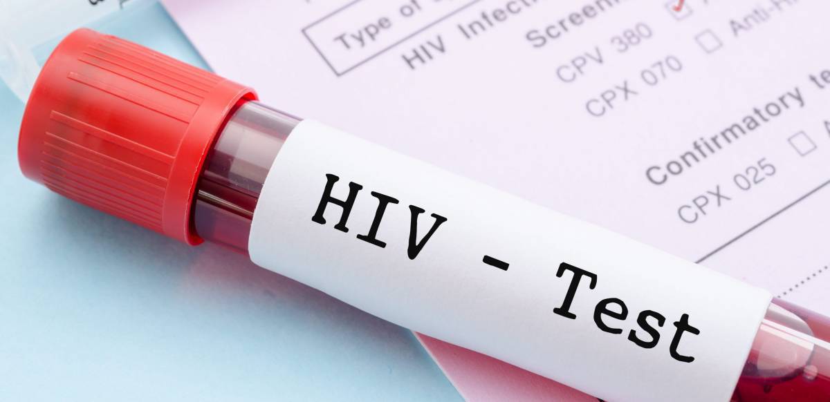 Con precauciones, se abre una nueva vía contra el VIH.