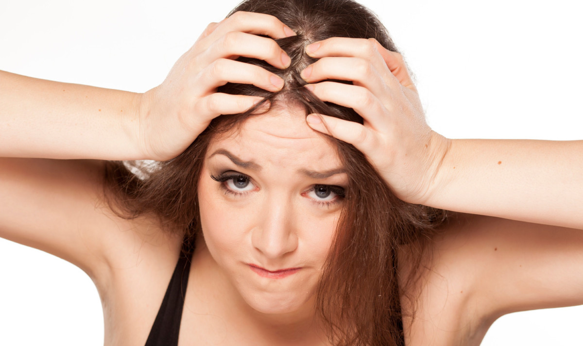 El principal síntoma de la alopecia por tracción es dolor de cabeza.