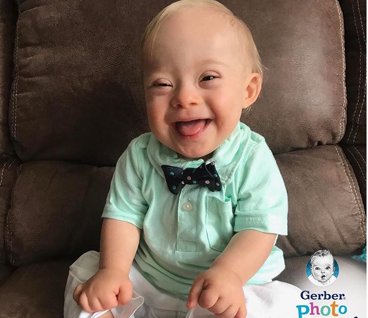 Lucas, el bebé con síndrome de Down que ha sido elegido como imagen de Gerber