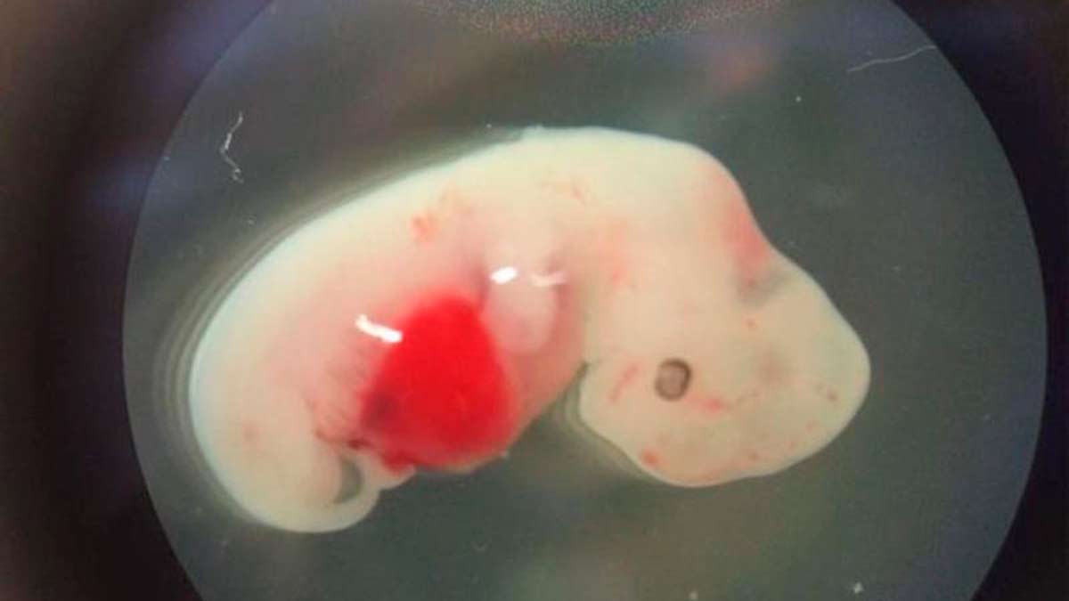 Forma del embrión conseguido