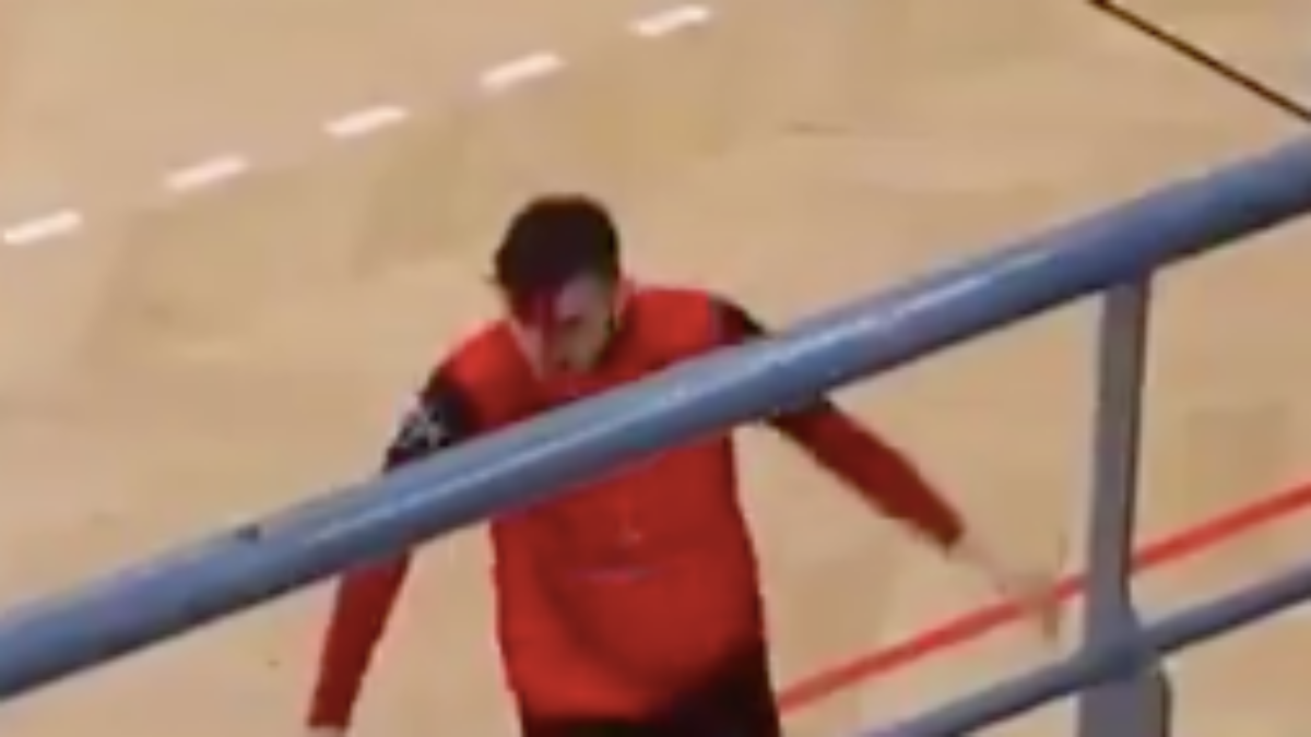 Alejo Rivas, jugador de hockey del Burguillos, brutalmente agredido ante el Alhambra.