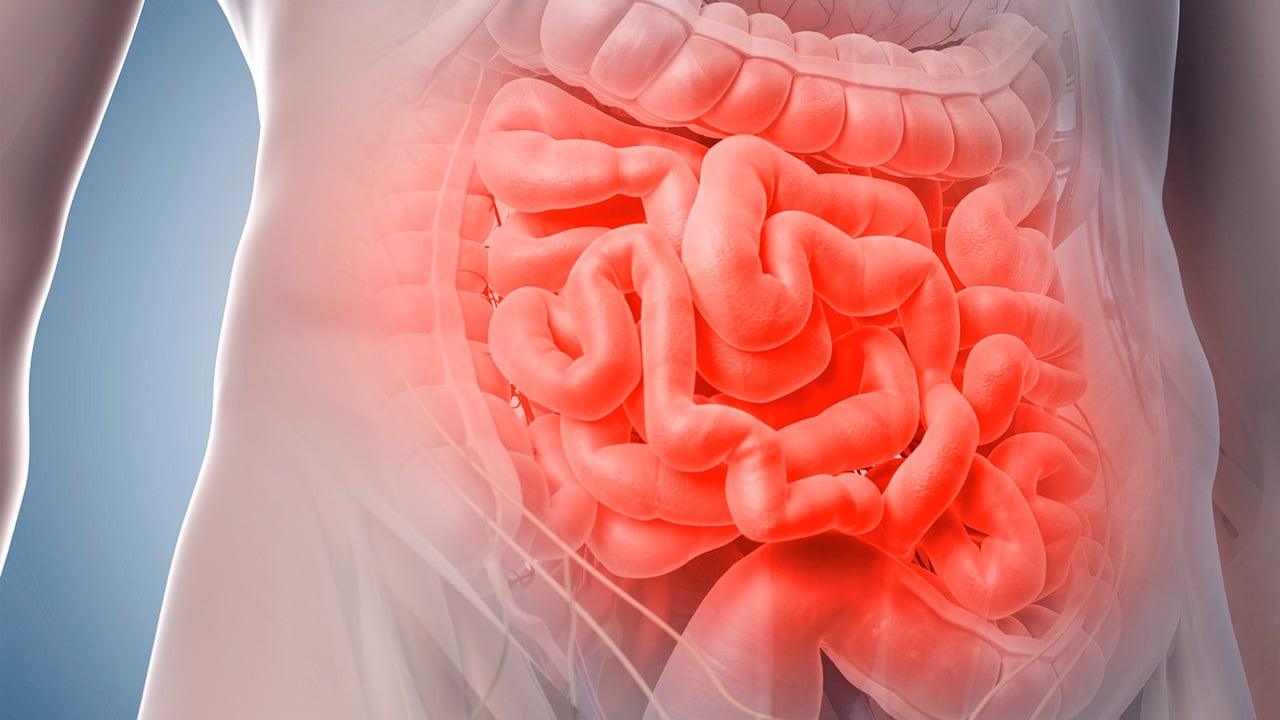 Un ensayo clínico logra pacientes sin cáncer de intestino durante casi tres años