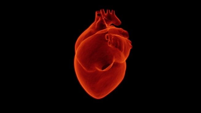 Conoce los distintos tipos de infarto.