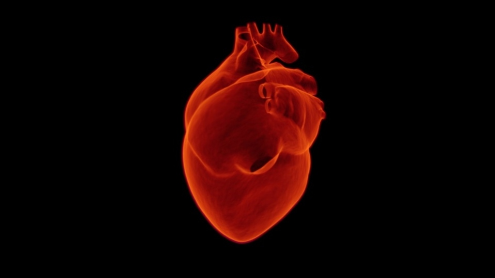 El infarto de miocardio es de los más populares.