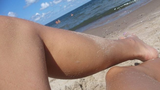 Como se desaparecen las venas varices